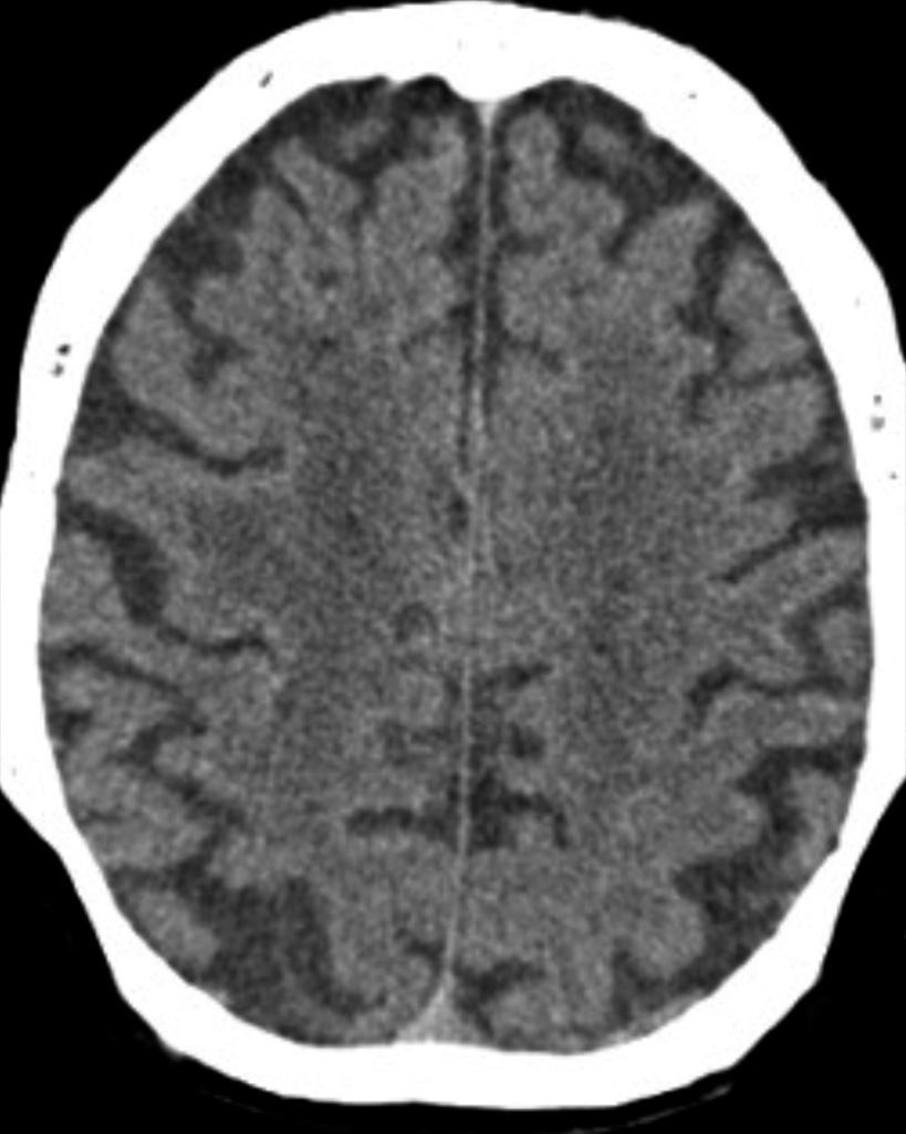 a5255502d6911df8a390800200c9a66