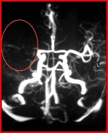 b5092261f11df8a390800200c9a66