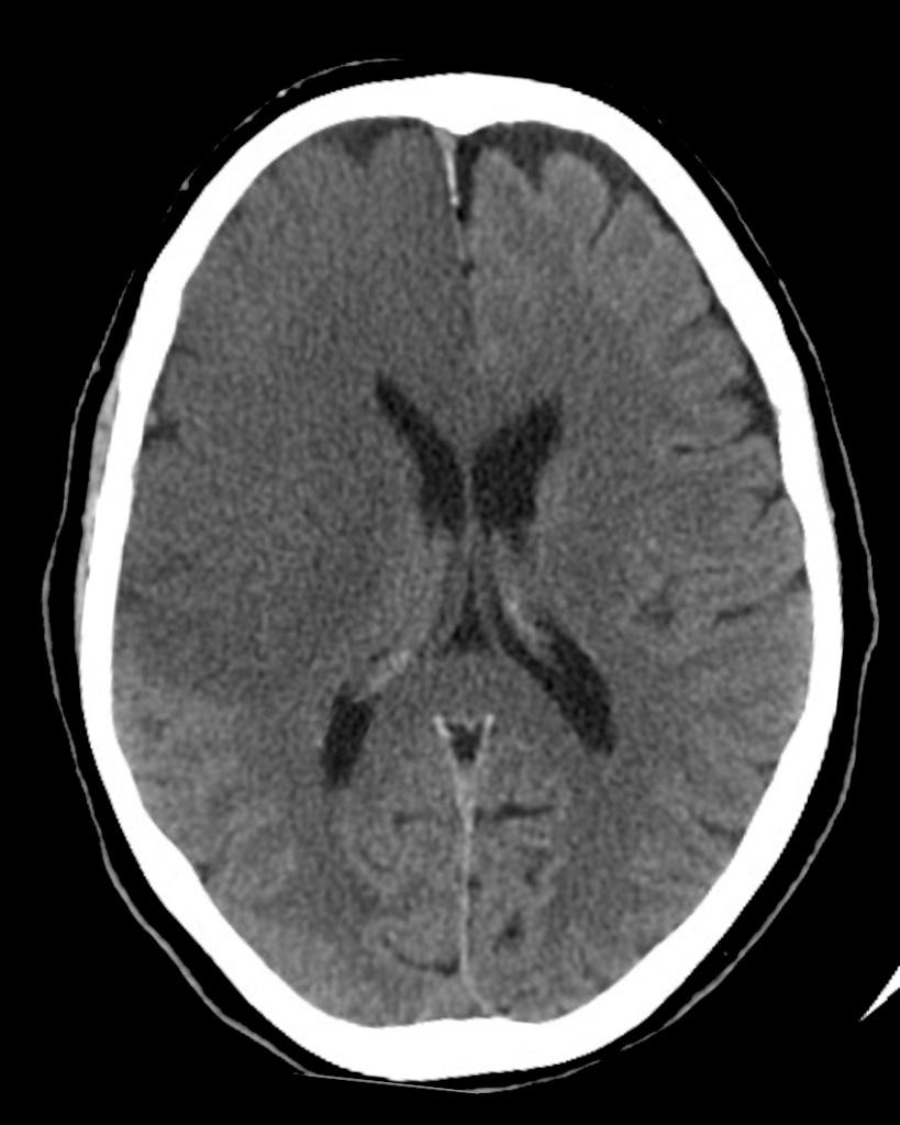 b5095261f11df8a390800200c9a66