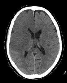 b5095261f11df8a390800200c9a66a