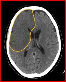 b5096261f11df8a390800200c9a66