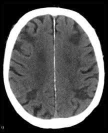 b5097261f11df8a390800200c9a66