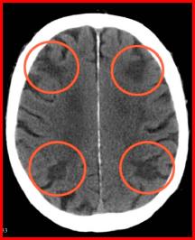 b5098261f11df8a390800200c9a66