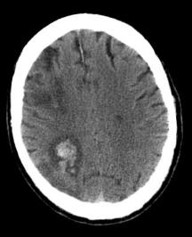 b50a1261f11df8a390800200c9a66