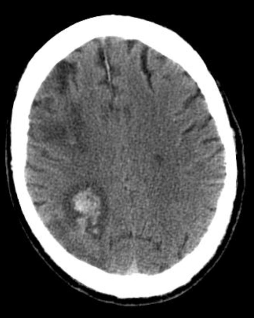 b50a1261f11df8a390800200c9a66