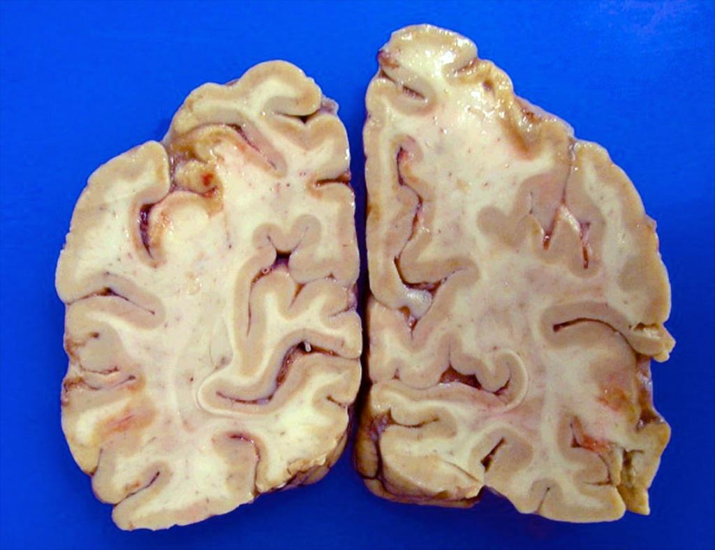 b50a2261f11df8a390800200c9a66