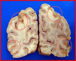 b50a3261f11df8a390800200c9a66