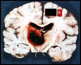 b50a4261f11df8a390800200c9a66