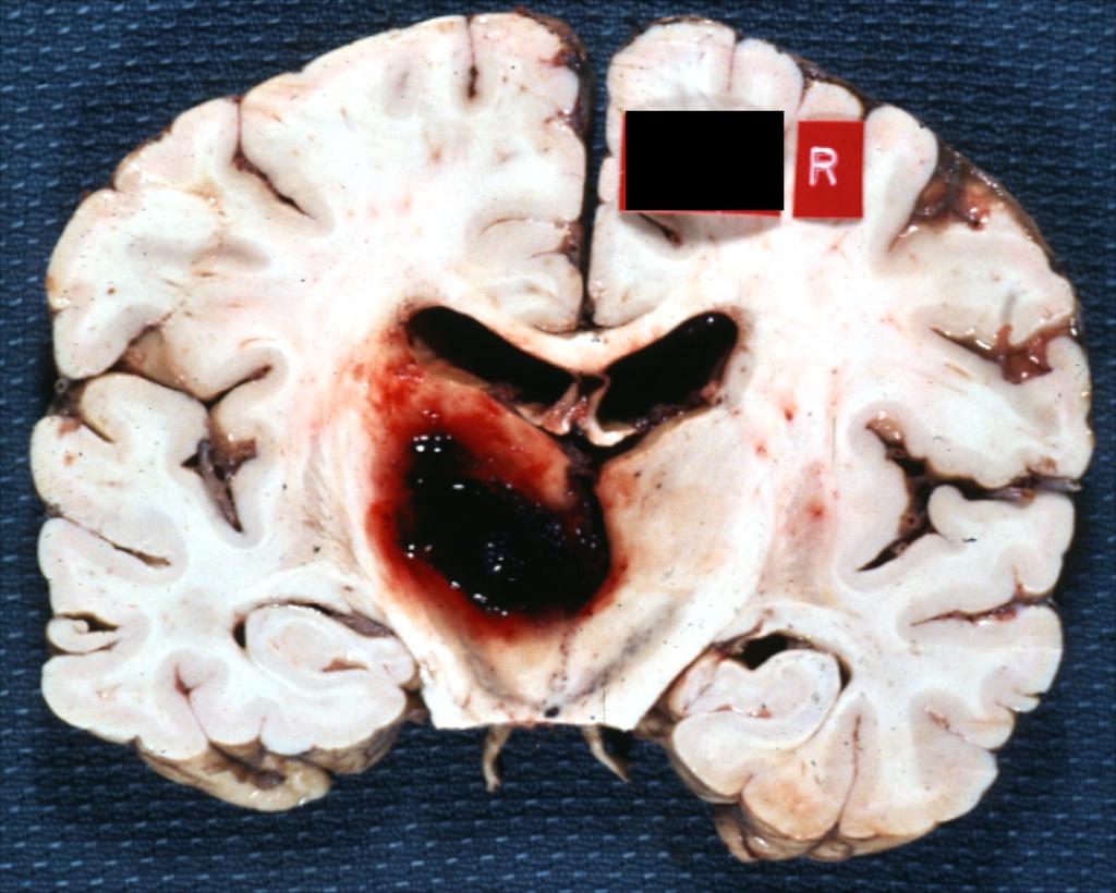 b50a4261f11df8a390800200c9a66