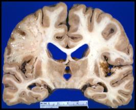 b50a5261f11df8a390800200c9a66