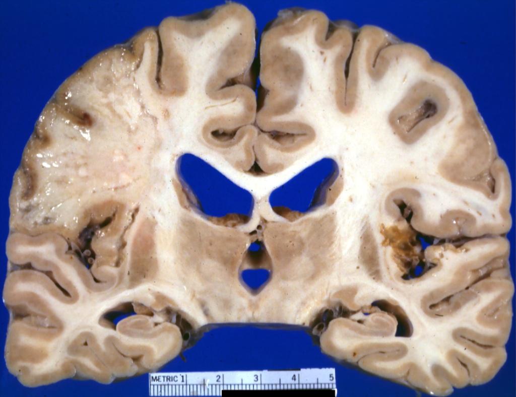 b50a5261f11df8a390800200c9a66