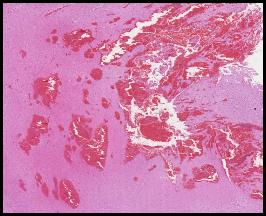 b50a6261f11df8a390800200c9a66