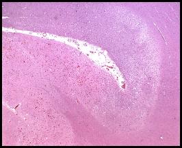 b77a0261f11df8a390800200c9a66