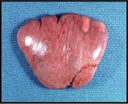 b77b2261f11df8a390800200c9a66