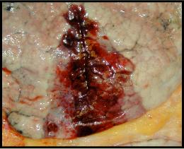 b77b4261f11df8a390800200c9a66