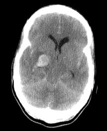 b77c3261f11df8a390800200c9a66