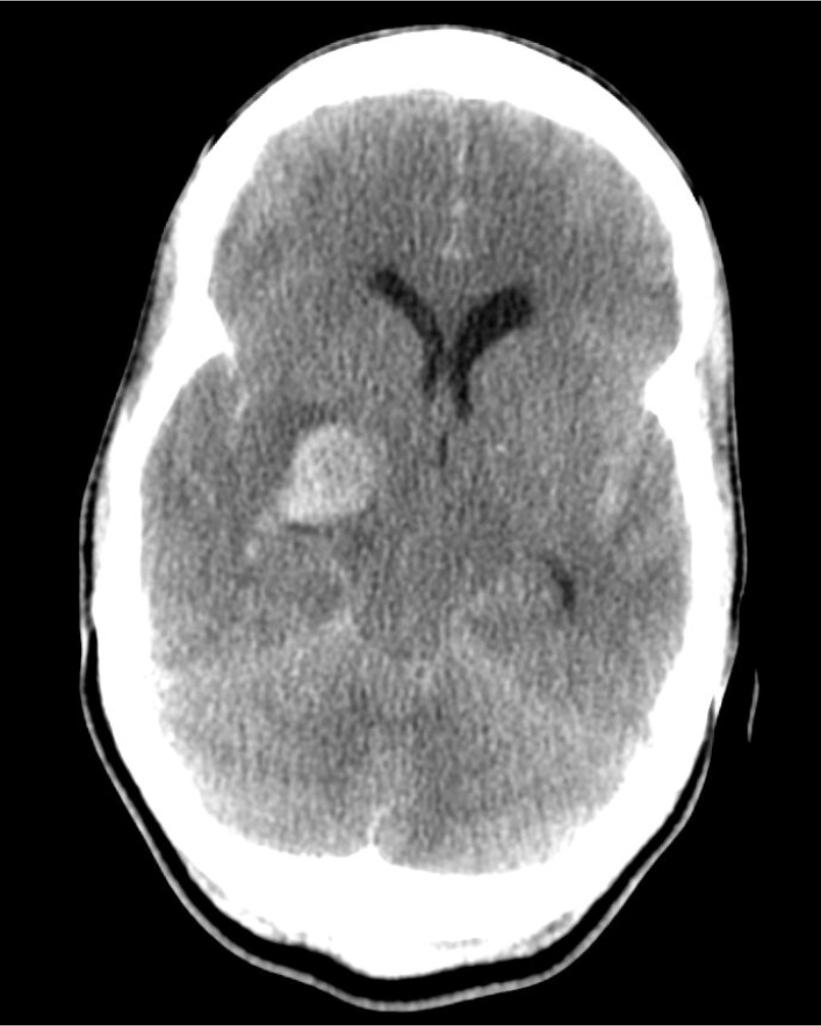 b77c3261f11df8a390800200c9a66a