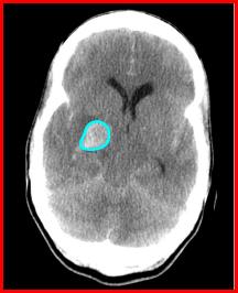 b77c7261f11df8a390800200c9a66