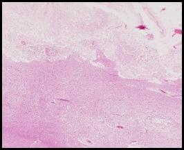 b77d0261f11df8a390800200c9a66