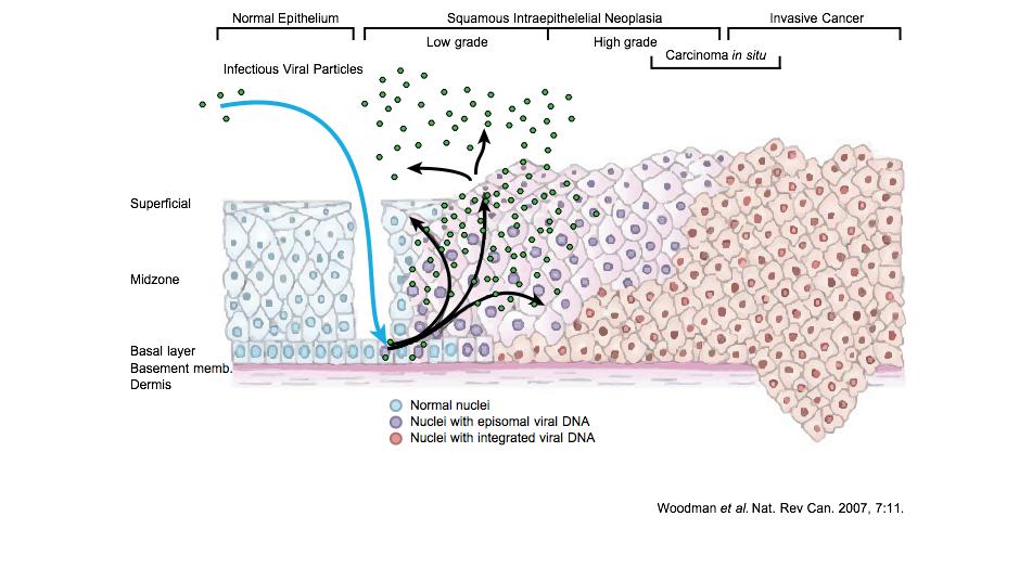 HPV
